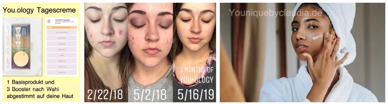 Younique Youology Tagescreme Rosazea Rosacea Neurodermitis Schuppenflechte Couperose